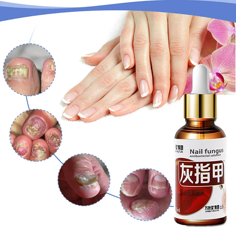 Removedor De Fungos Nail