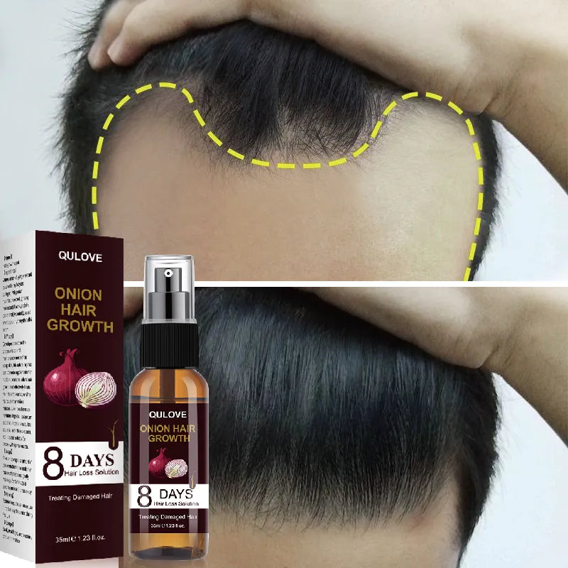 Quilove Essência Para O Crescimento De Cabelo