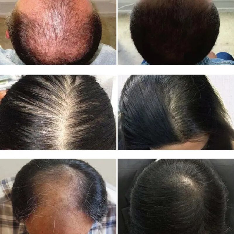 Quilove Essência Para O Crescimento De Cabelo
