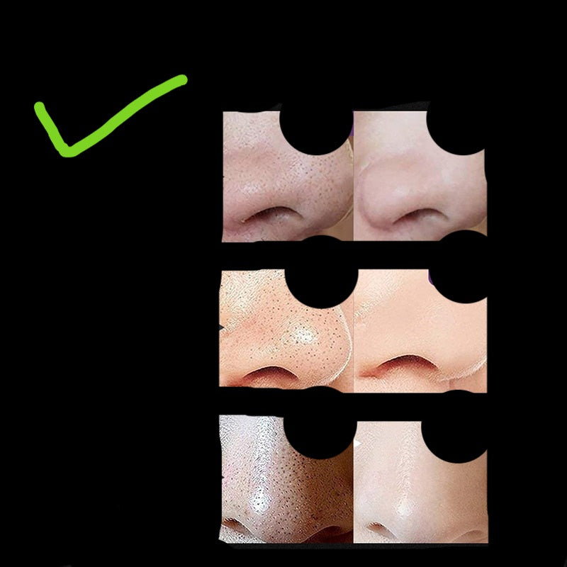 AUQUEST-Removedor De Cravos